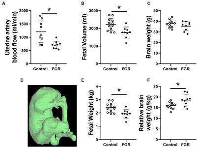 Acute-on-chronic: using magnetic resonance imaging to disentangle the haemodynamic responses to acute and chronic fetal hypoxaemia